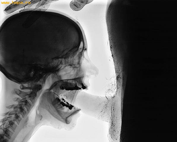 70756_X-RAY_BLOW_JOB_1146762822_1120594_1.jpg