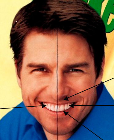 Tom-Cruise-Smile-Bay-Dental-And-Orthodontics-Sydney-Australia_1237308_0.png